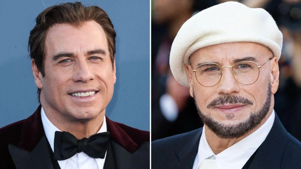 John Travolta's Dramatic Transformation Sparks Cosmetic Speculation